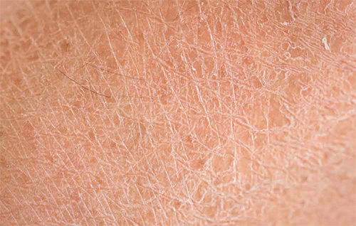 Tên các bệnh gây ngứa da và cách phòng tránh