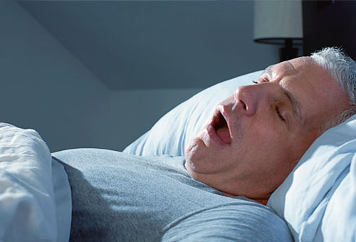 Ngáy và ngủ ngày nhiều là một trong những triệu chứng ngưng thở khi ngủ