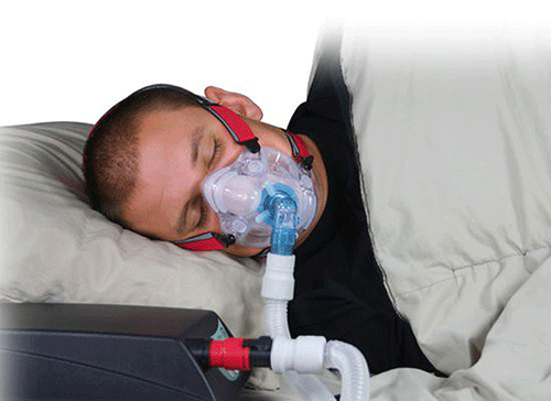 Sử dụng thiết bị miệng để khắc phục chứng ngưng thở khi ngủ