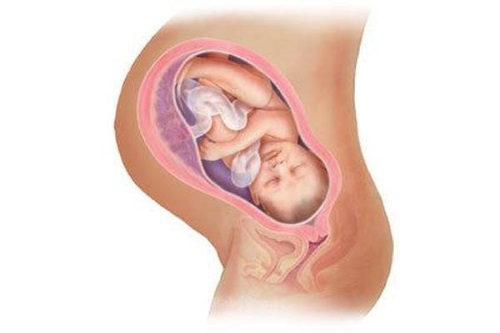 Tìm hiểu về  thai ngôi ngược