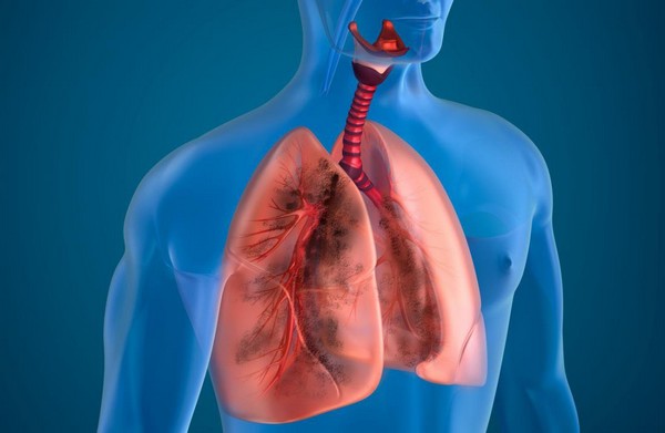Bệnh tắc nghẽn phổi mãn tính là bệnh gì?