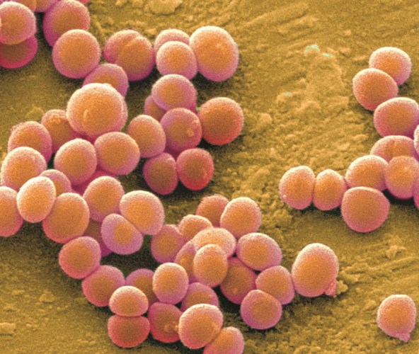 staphylococcus-aureus-1414506130358