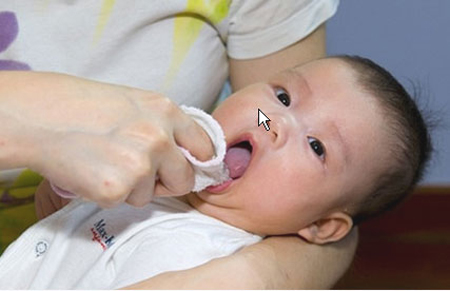 Vệ sinh miệng đúng cách cho bé sơ sinh