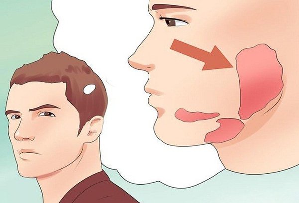 Tác hại khôn lường của bệnh viêm tuyến nước bọt mang tai