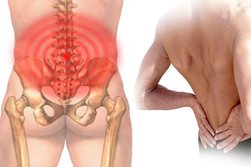 Dược sĩ chia sẻ những triệu chứng của bệnh đau cột sống thắt lưng