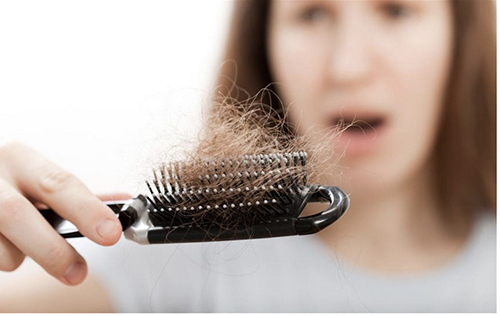 Rụng tóc và những điều cần biết để nhận điều trị đúng cách