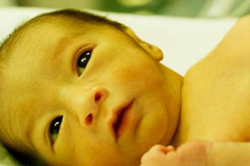 Chứng vàng da ở trẻ sơ sinh nguyên nhân là do đâu mà có?