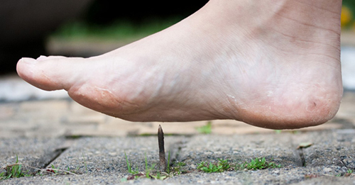 Viêm loét nhiễm trùng ở chân có thể dẫn đến bệnh uốn ván