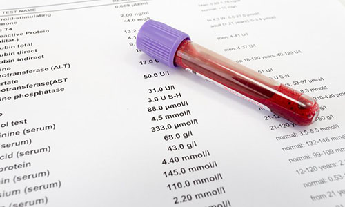 Chuyên gia cảnh báo 4 chỉ số xét nghiệm rối loạn mỡ máu