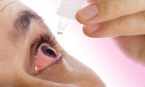 Chuyên gia Điều dưỡng chỉ ra phương pháp trị đau mắt đỏ tại nhà