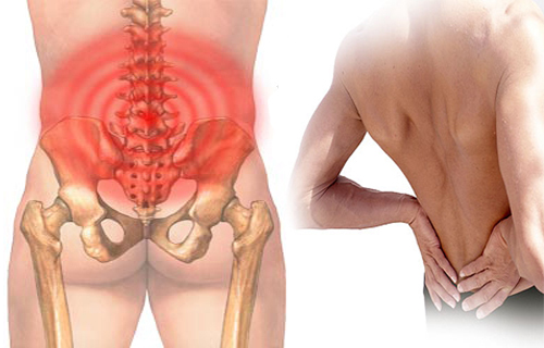 Nguyên nhân thường gặp nào dẫn đến tình trạng đau lưng