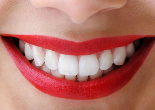 Hướng dẫn cách chăm sóc răng sứ kim loại