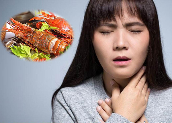 Bệnh nhân bị viêm họng thì có nên ăn hải sản không?