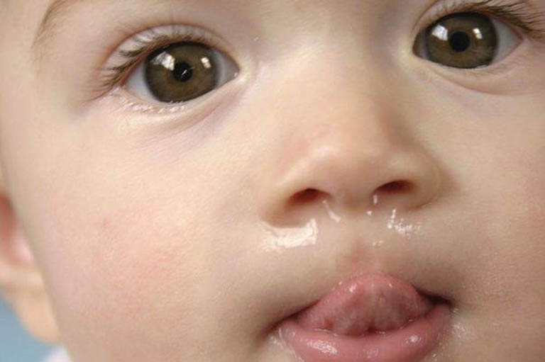 Trẻ bị chảy nước mũi trong do đâu?