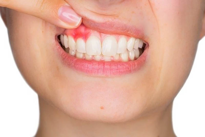 Dược sĩ chia sẻ phương pháp trị đau răng hiệu quả, nhanh chóng